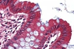Kv1.3 Antibody, Novus Biologicals 50 &mu;g; Unconjugated:Antibodies, Polyclonal